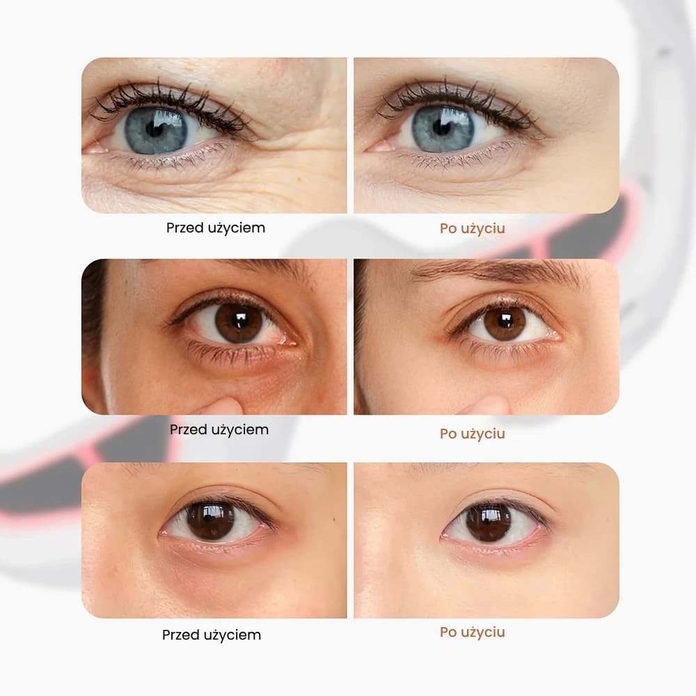 EyeSoother- Masażer okolic oczu